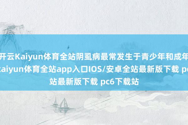 开云Kaiyun体育全站阴虱病最常发生于青少年和成年东谈主-kaiyun体育全站app入口IOS/安卓全站最新版下载 pc6下载站